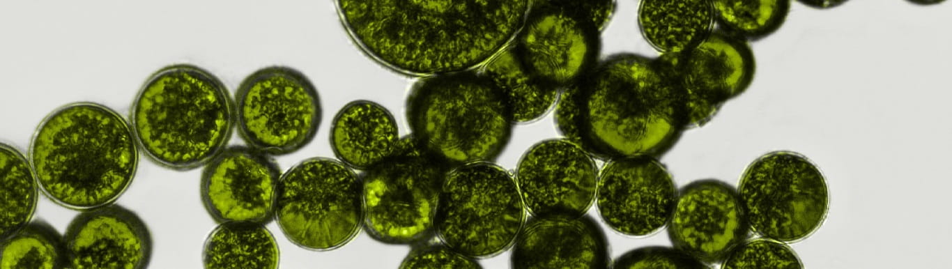 Bacteria under a microscrope